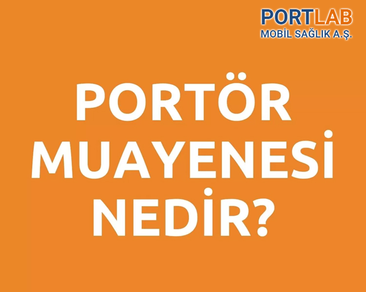Mobil Portör Testi Nedir
