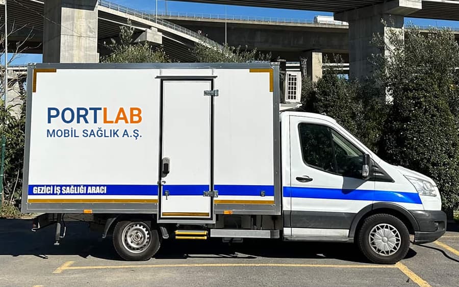 Mobil Sağlık Aracı ile İşyerinde Sağlık Devrimi